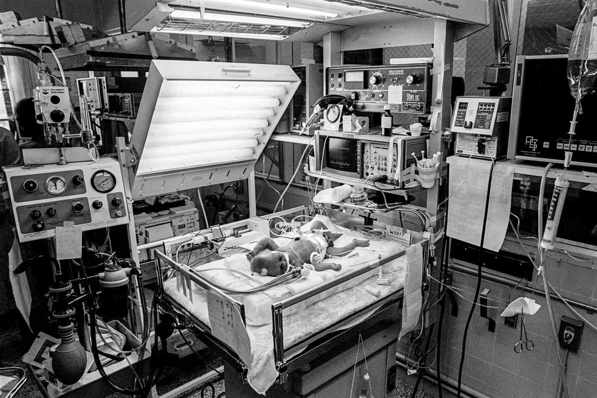Preemie Baby unit at St Joseph's Hospital. I.C.U. The technology in a modern hospital. Showing IV Pump. Cardiac & Respiratory monitor. Respirator. Umbilical catheter in navel. 3 Electrodes for heart & respiratory rate, endotracheal tube in nose. Preemie baby under 2 lb at birth.