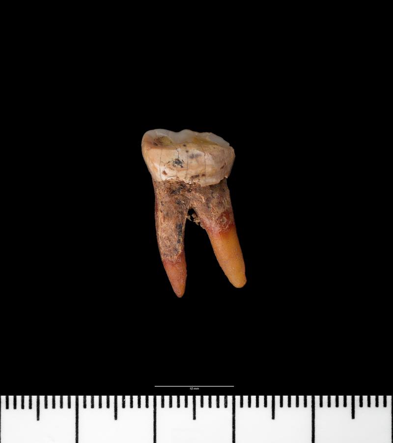 Bronze Age / Roman human tooth