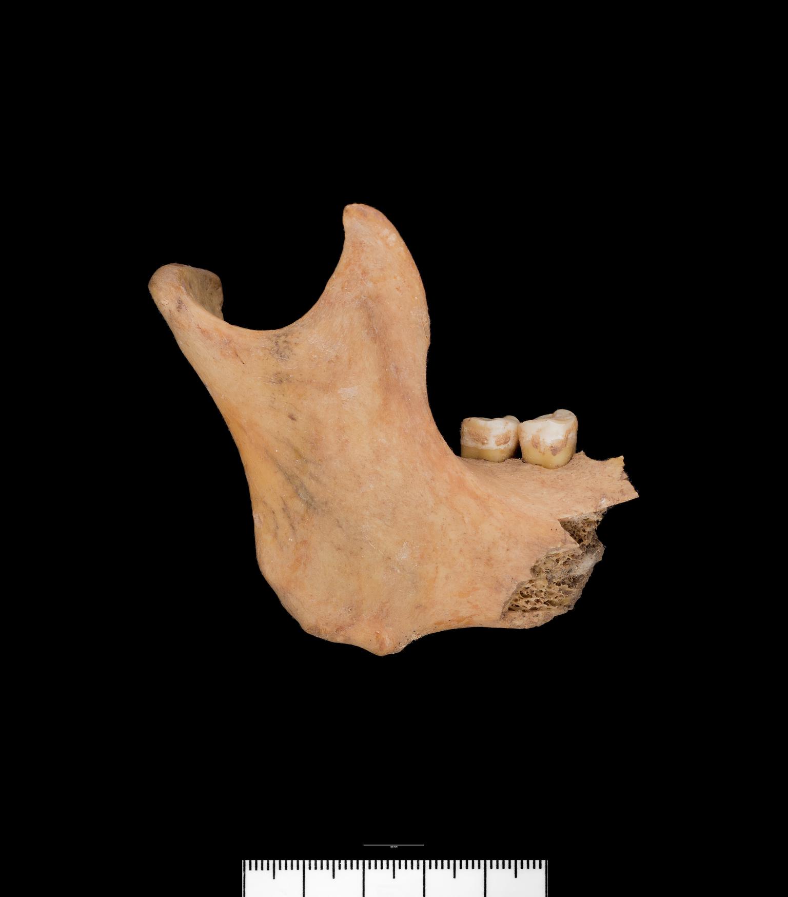Bronze Age / Roman human bone