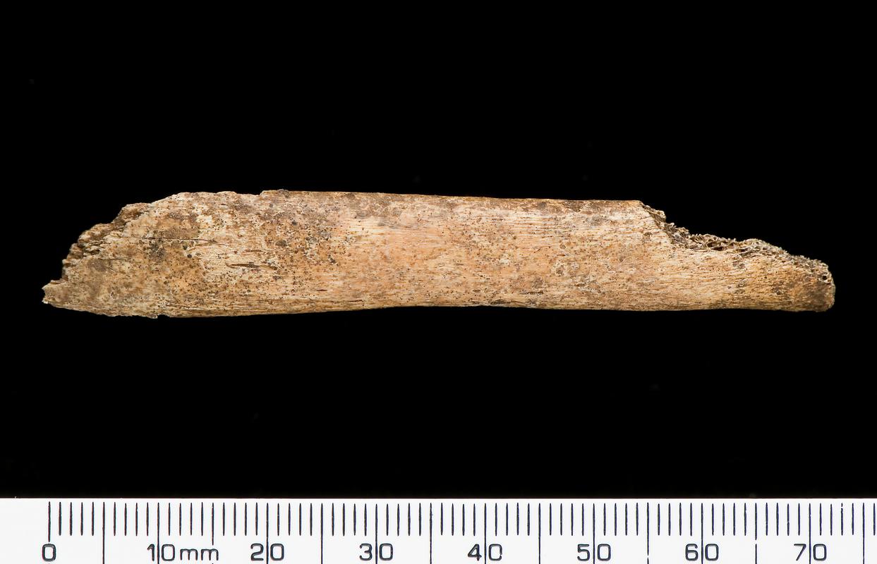 Early Medieval human remains