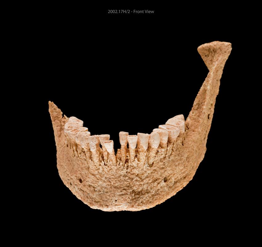 Early Medieval human remains