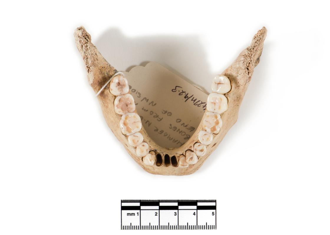 Neolithic human remains