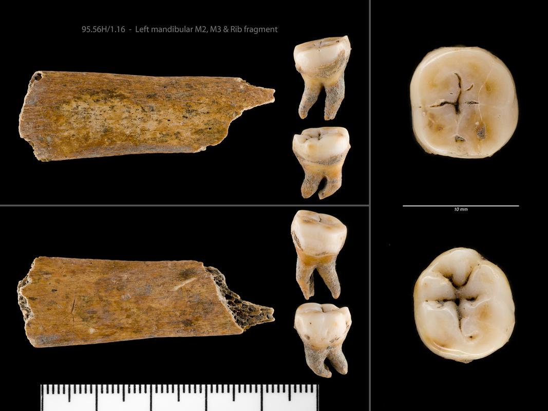 Early Medieval human remains