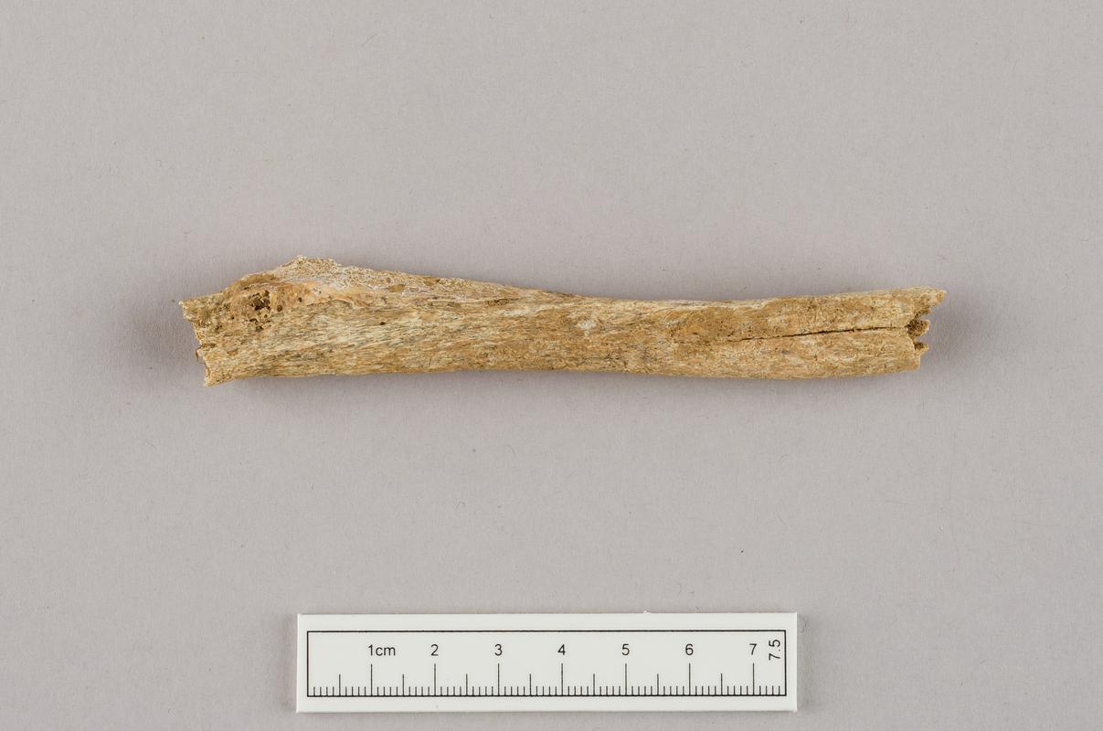 Undated human remains