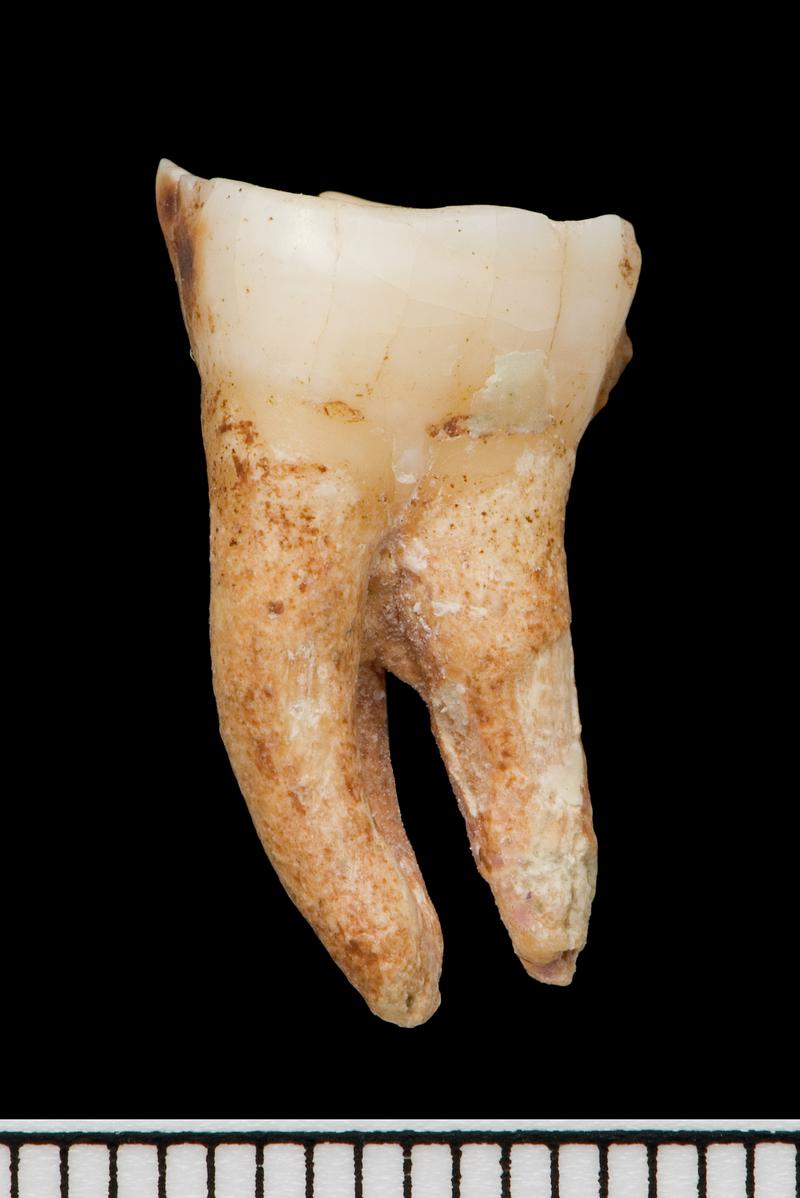 human molar from coffin skeleton