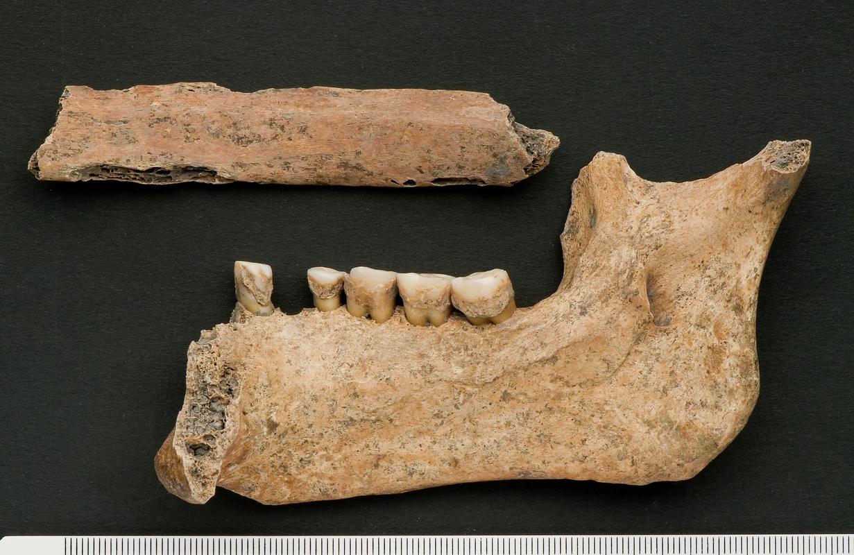 Early Medieval human remains