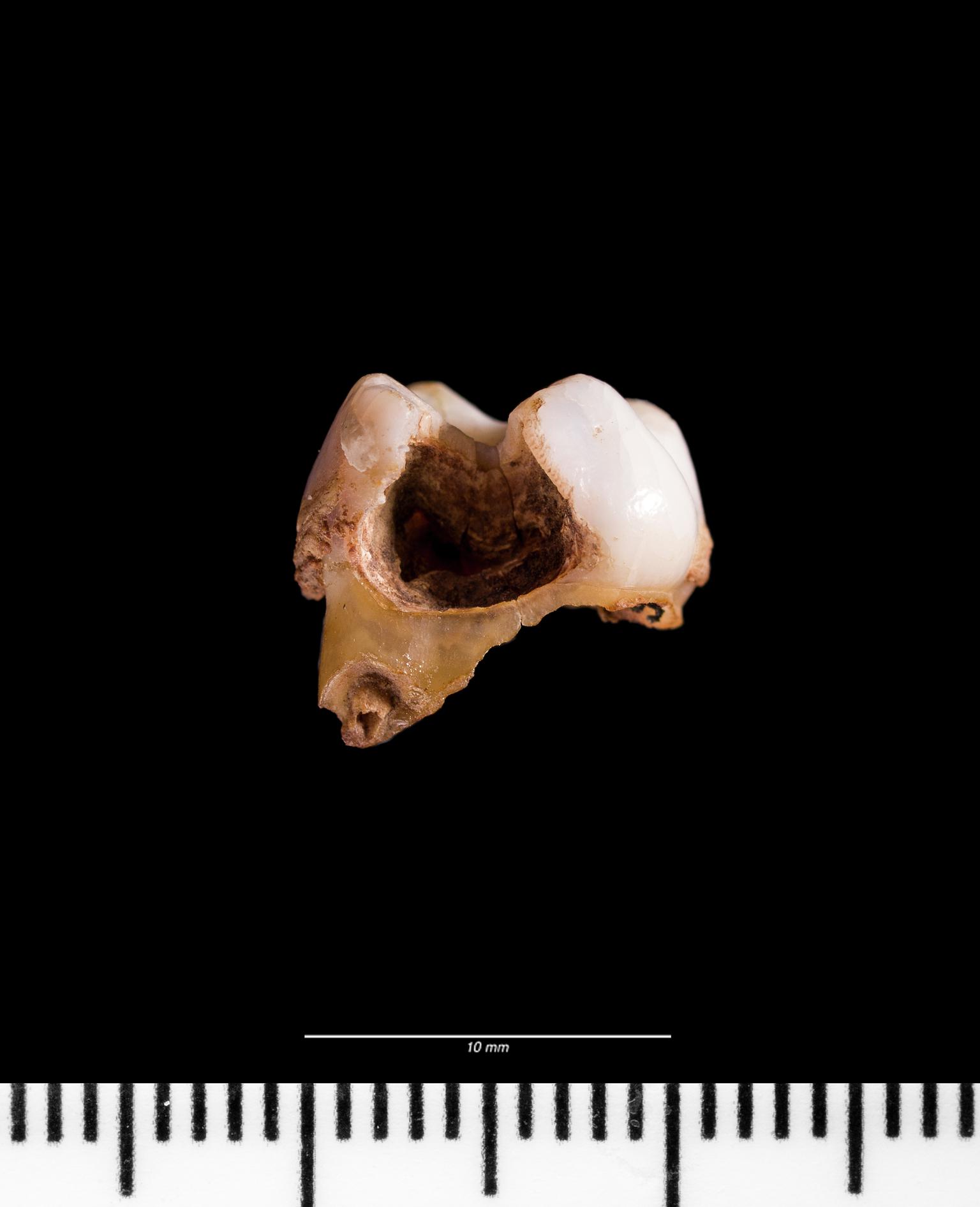 Roman human tooth