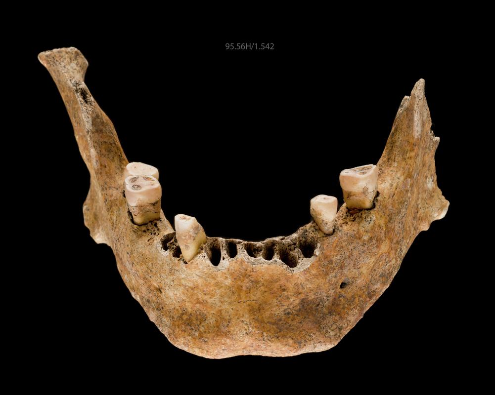 Early Medieval human remains
