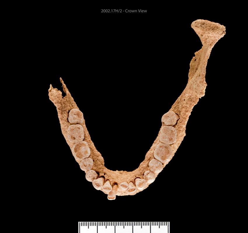 Early Medieval human remains
