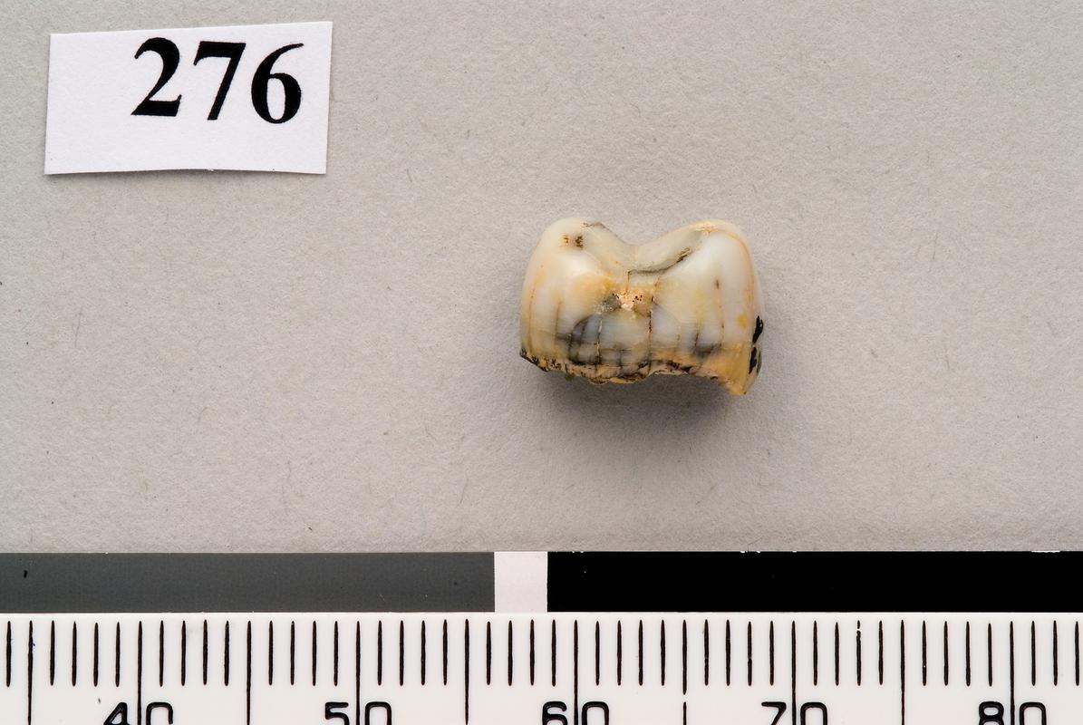 Lower Palaeolithic Neanderthal tooth