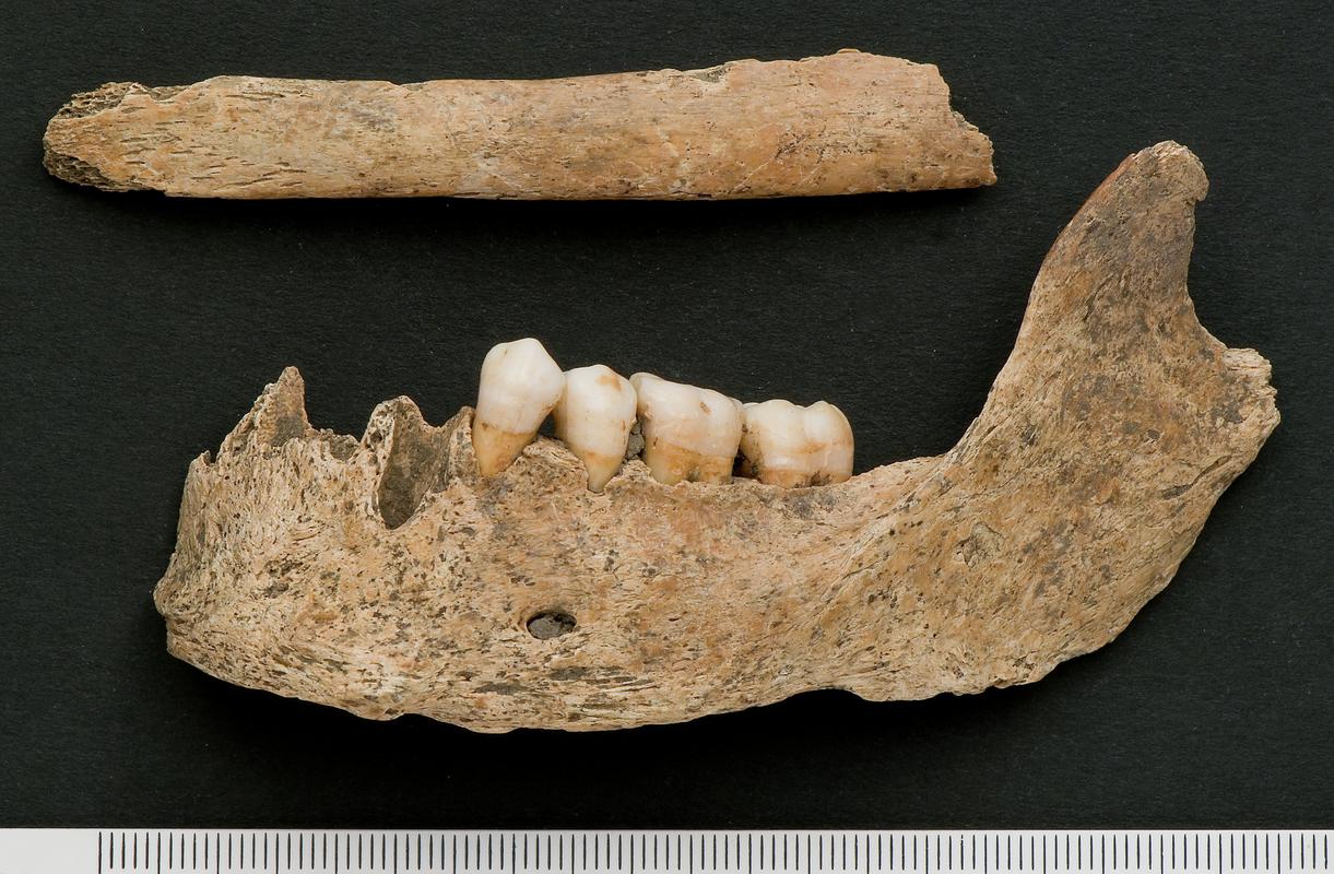 Left upper second molar - human and rib