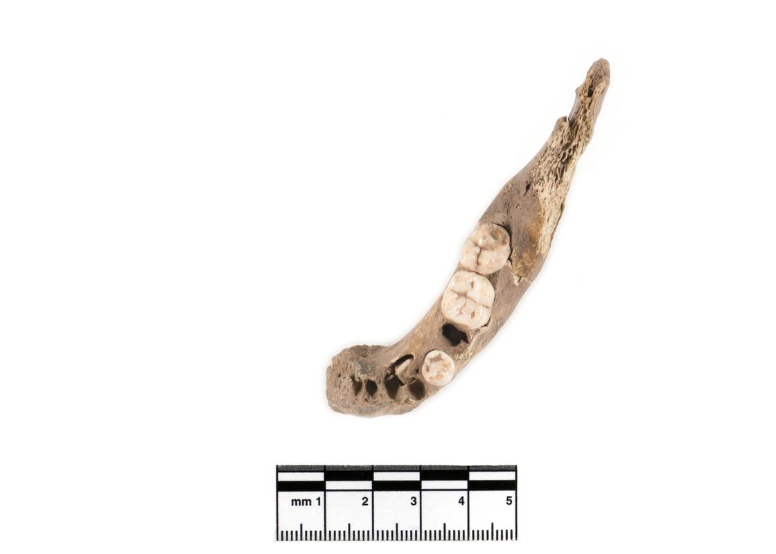 Neolithic human remains
