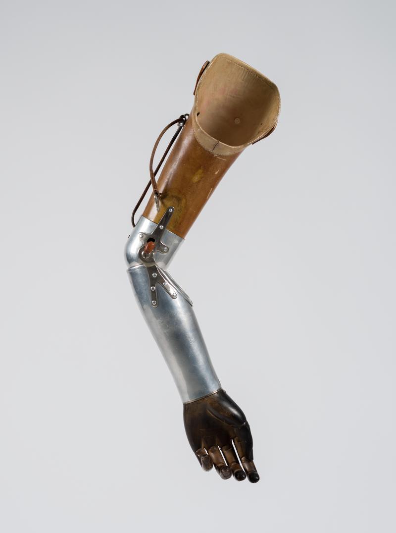 Prosthetic arm