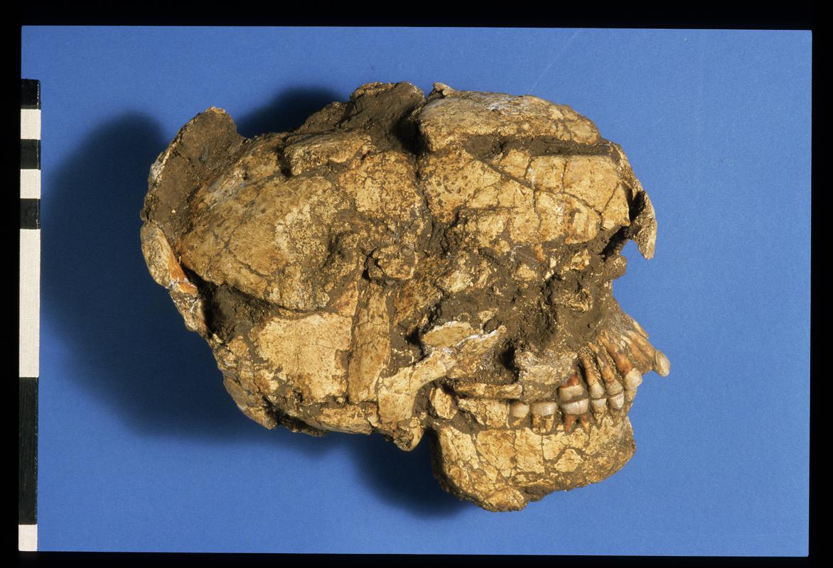 Human skull