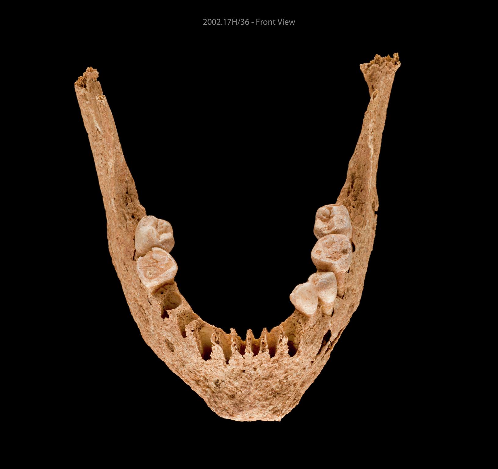 Early Medieval human remains