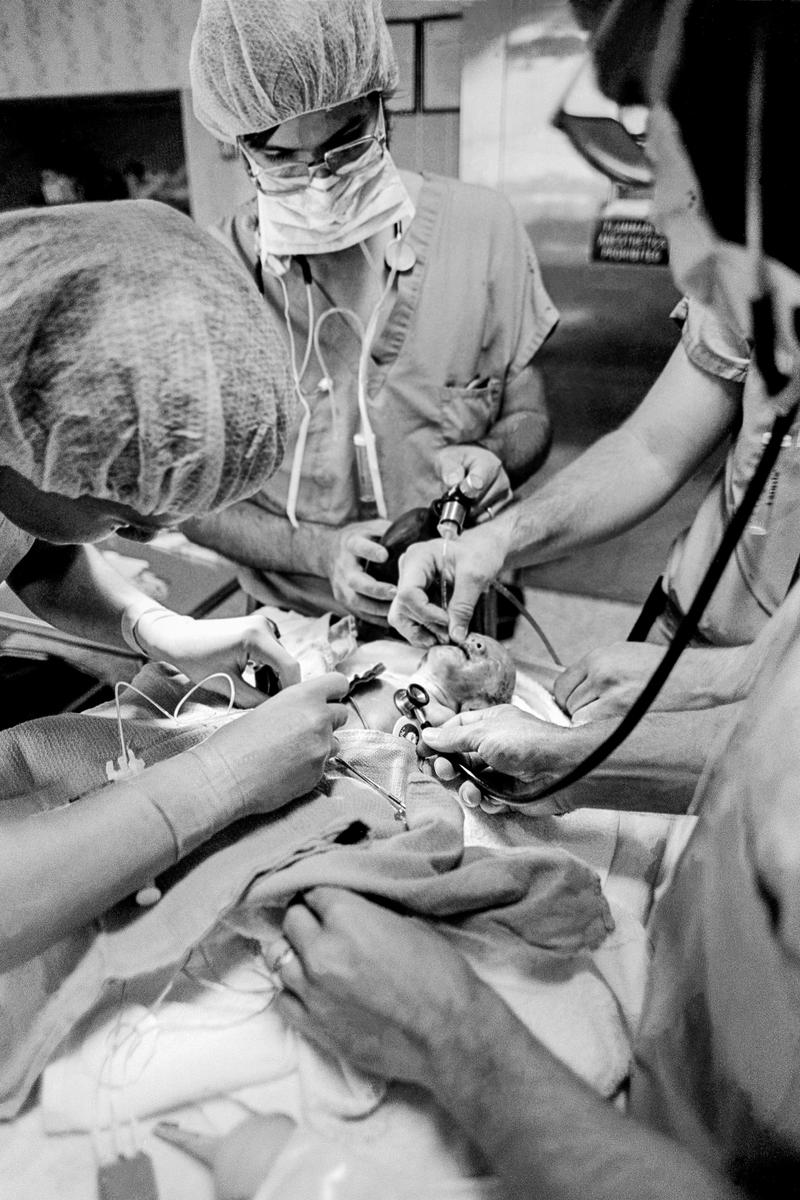 Preemie Baby unit at St Joseph's Hospital. Working within minutes on the birth of a preemie baby. An endotracheal tube and umbilical catheter being inserted.
