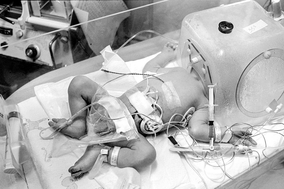 Preemie Baby unit at St Joseph's Hospital. I.C.U. Preemie baby with head in a humidifier and covered with the various attachments that help keep his functions stable. Phoenix, Arizona USA
