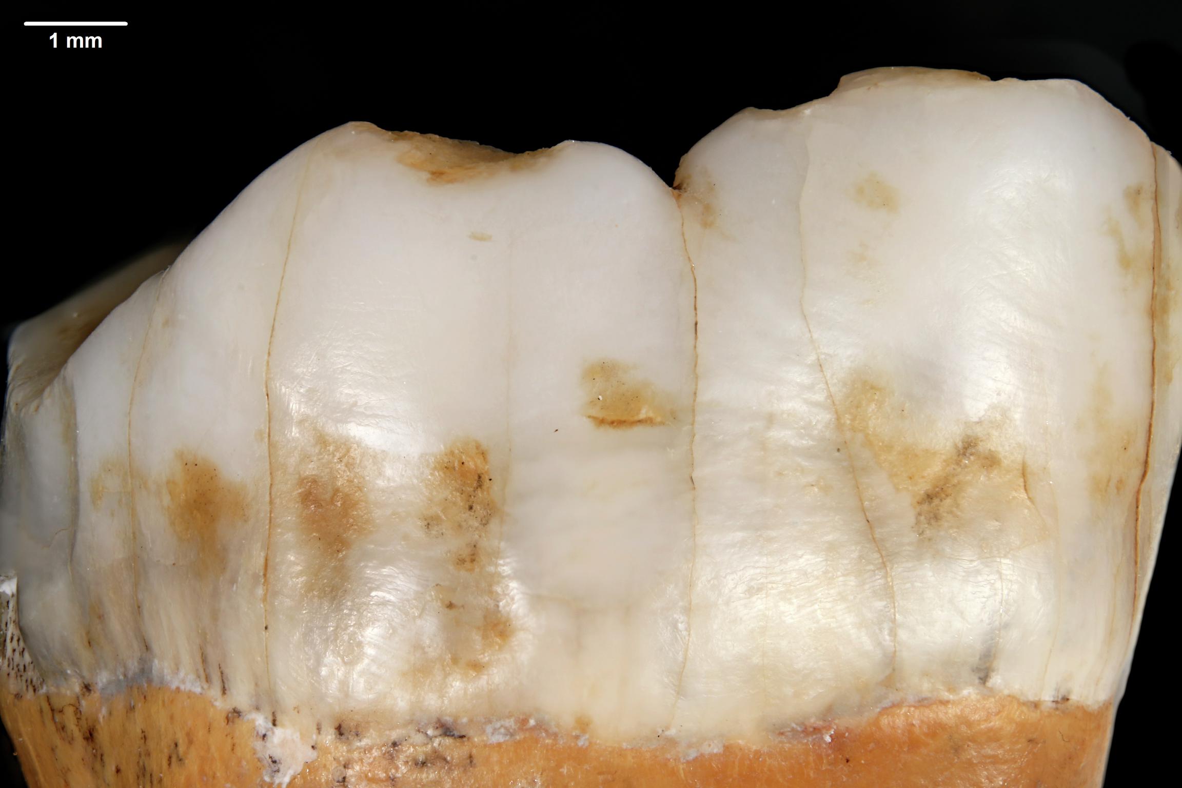 Lower Palaeolithic Neanderthal molar