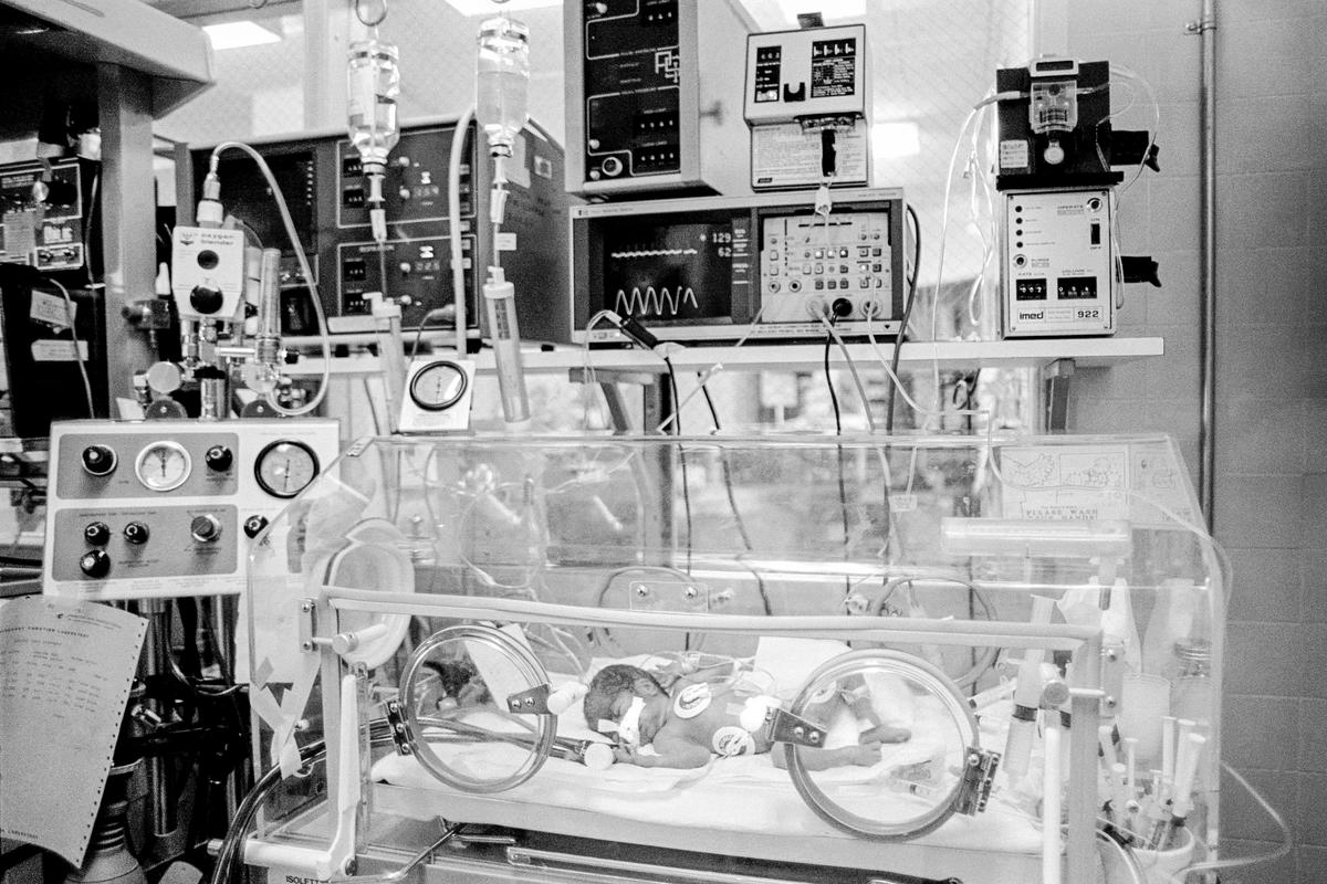 USA. ARIZONA. Phoenix. Preemie Baby unit at St Joseph's Hospital. I.C.U. Center; Isolette. Top Right; IV Pump. Middle; Cardiac & Respiratory monitor. Left; Respirator. Umbilical catheter in navel. 3 Electrodes for heart & respiratory rate, endotracheal tube in nose. Preemie baby under 2 lb at birth.