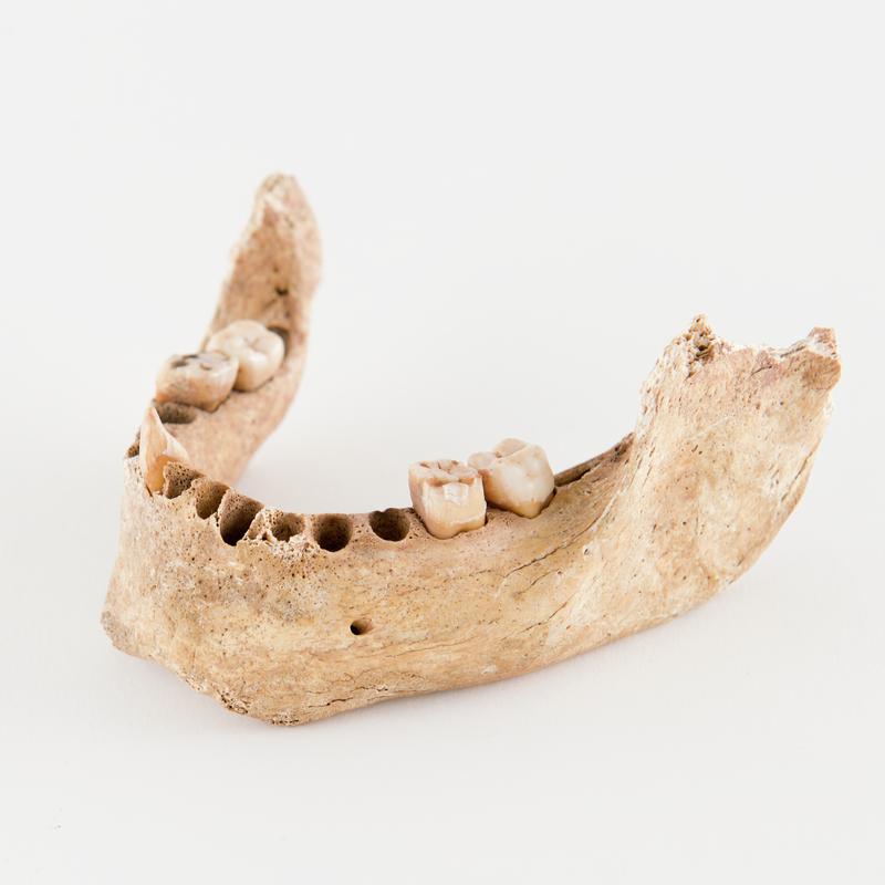 Neolithic human remains