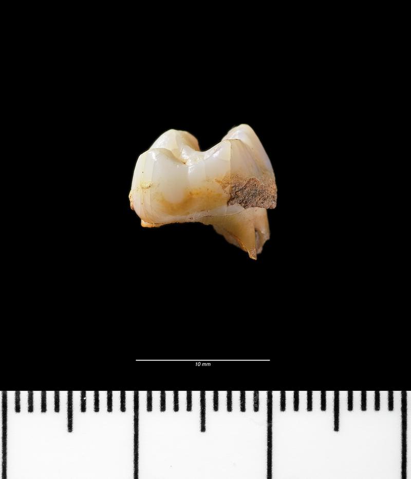 Roman human tooth