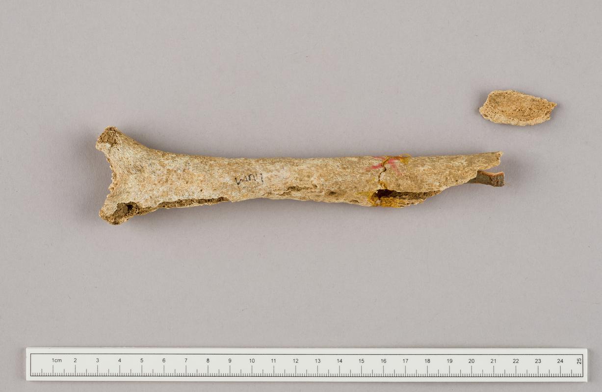 Undated human remains