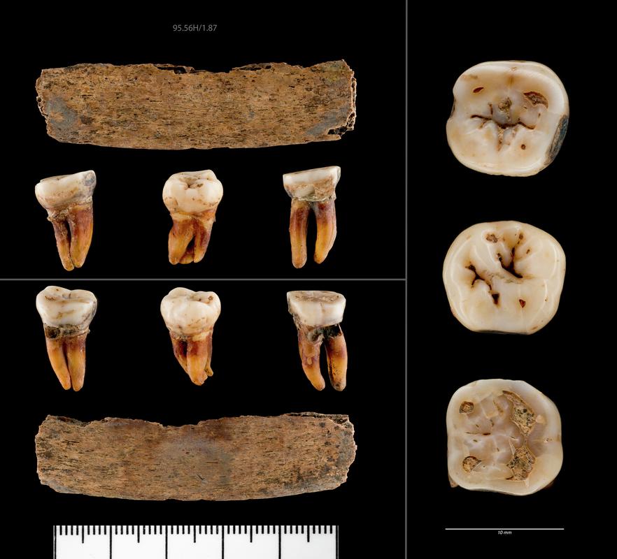 Left mandibular M2, Left mandibular M3 and Rib Fragment