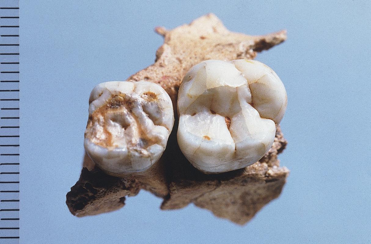 Lower Palaeolithic Neanderthal maxilla