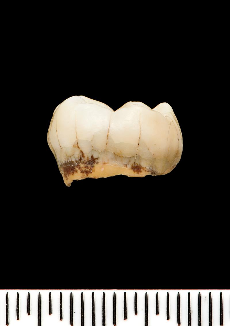 Lower Palaeolithic Neanderthal tooth
