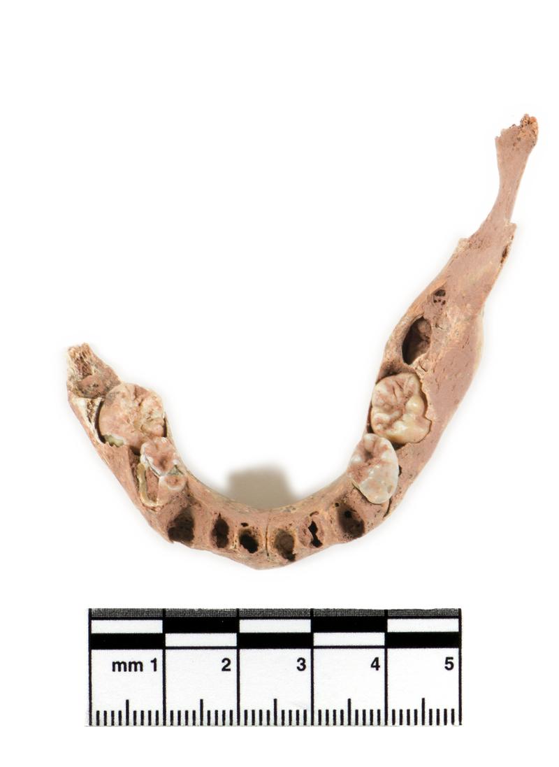 Neolithic human remains