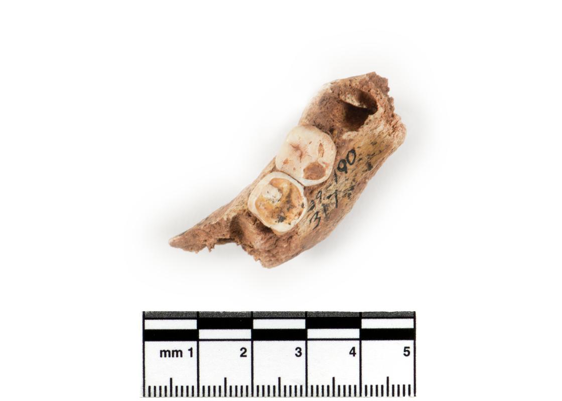 Neolithic human remains