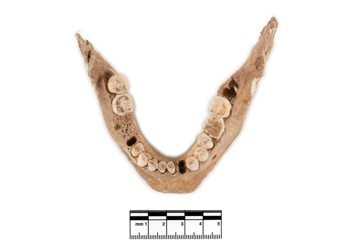 Neolithic human remains