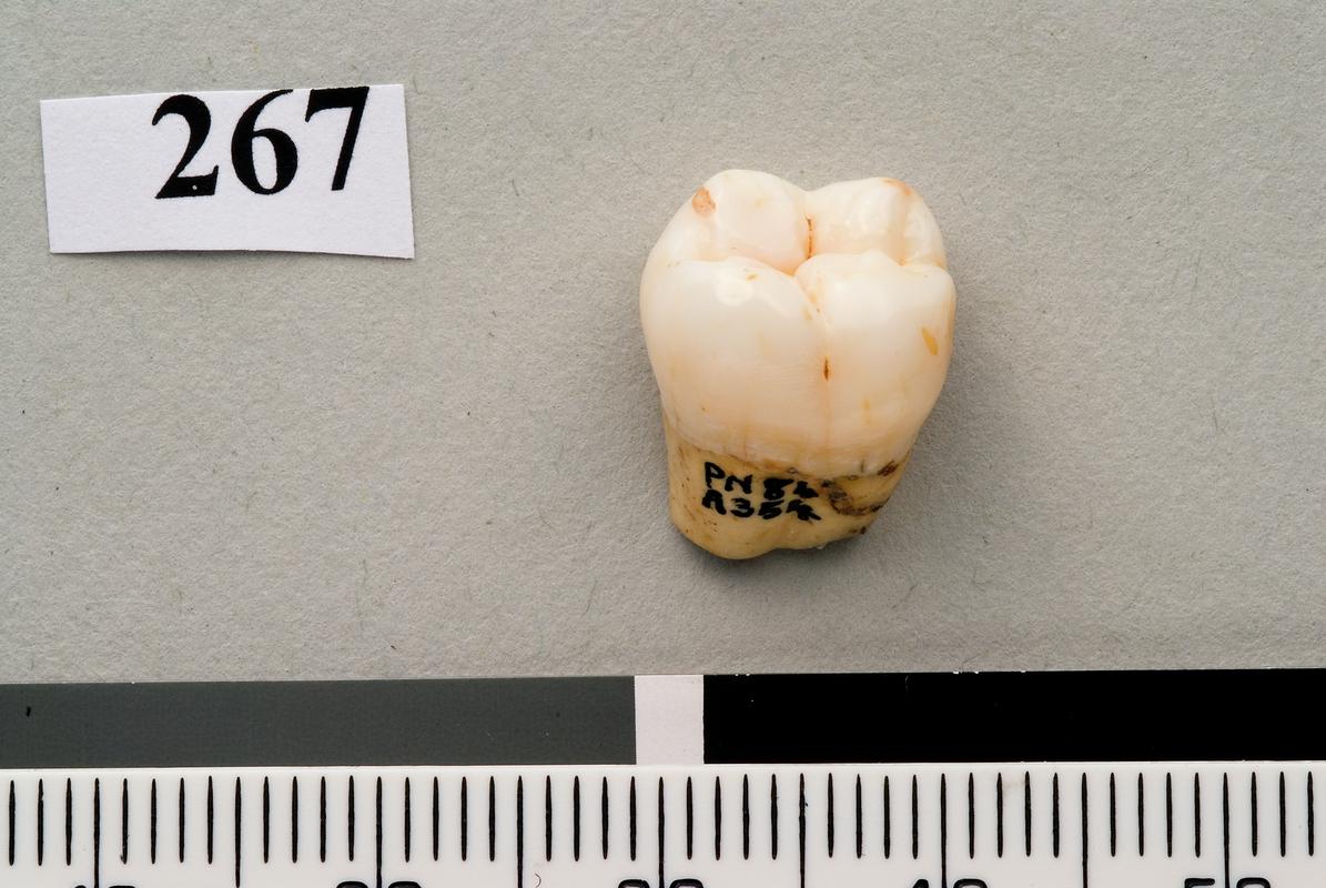 Lower Palaeolithic Neanderthal molar