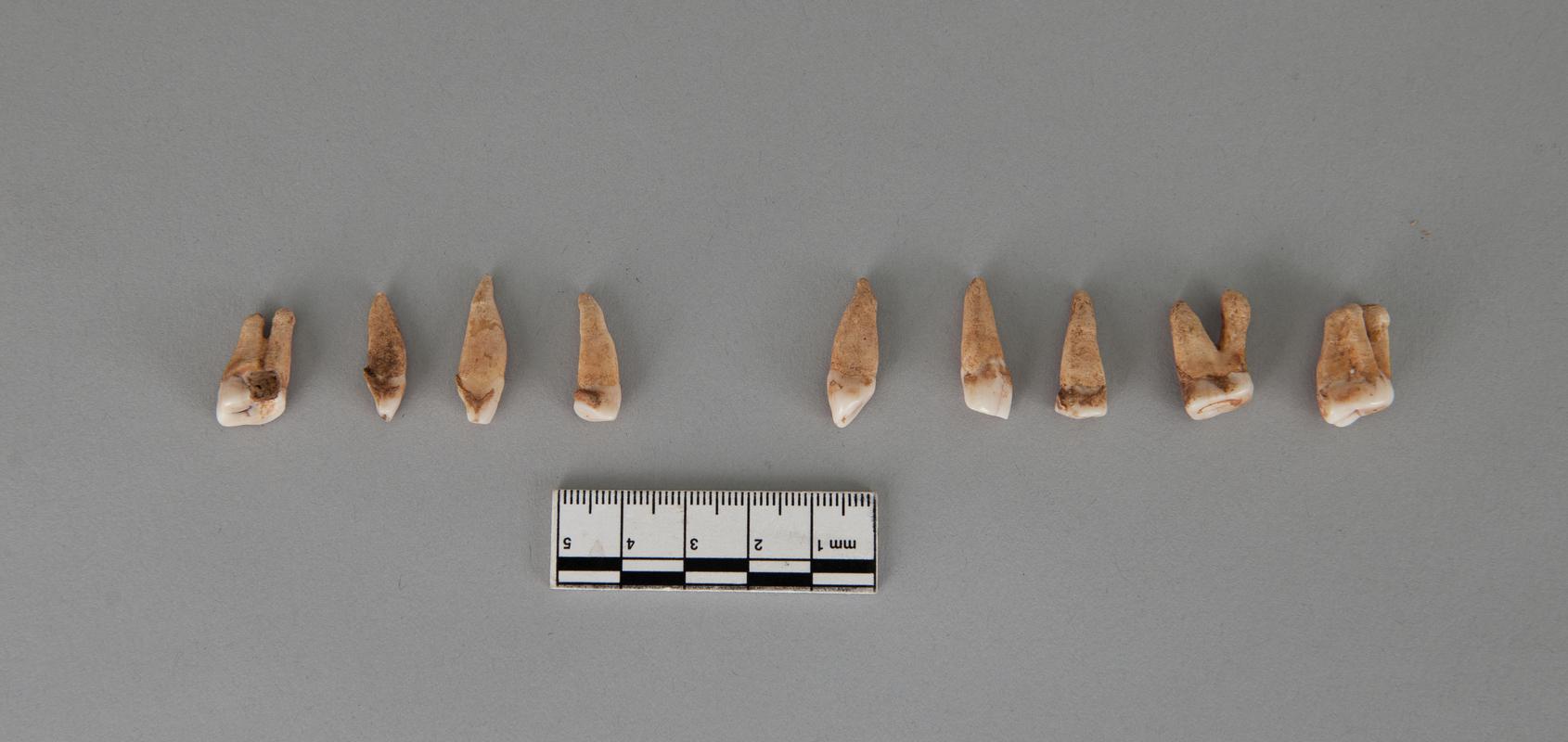 Early Medieval human remains