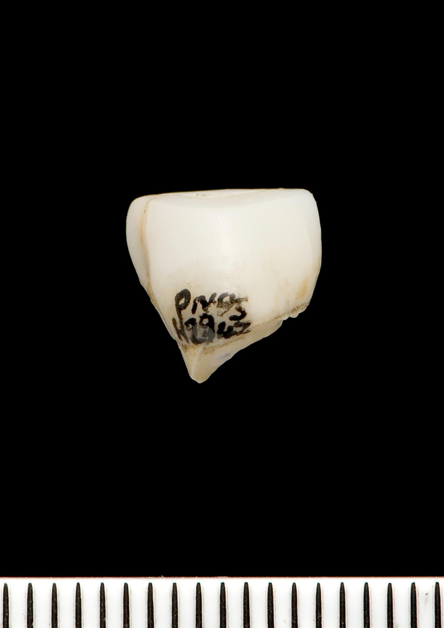 Lower Palaeolithic Neanderthal tooth