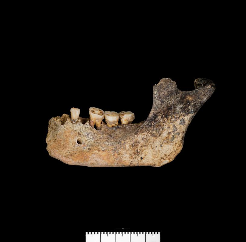 Middle Bronze Age human remains