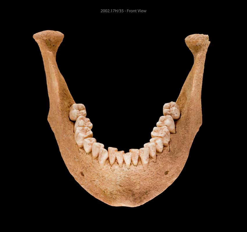 Early Medieval human remains