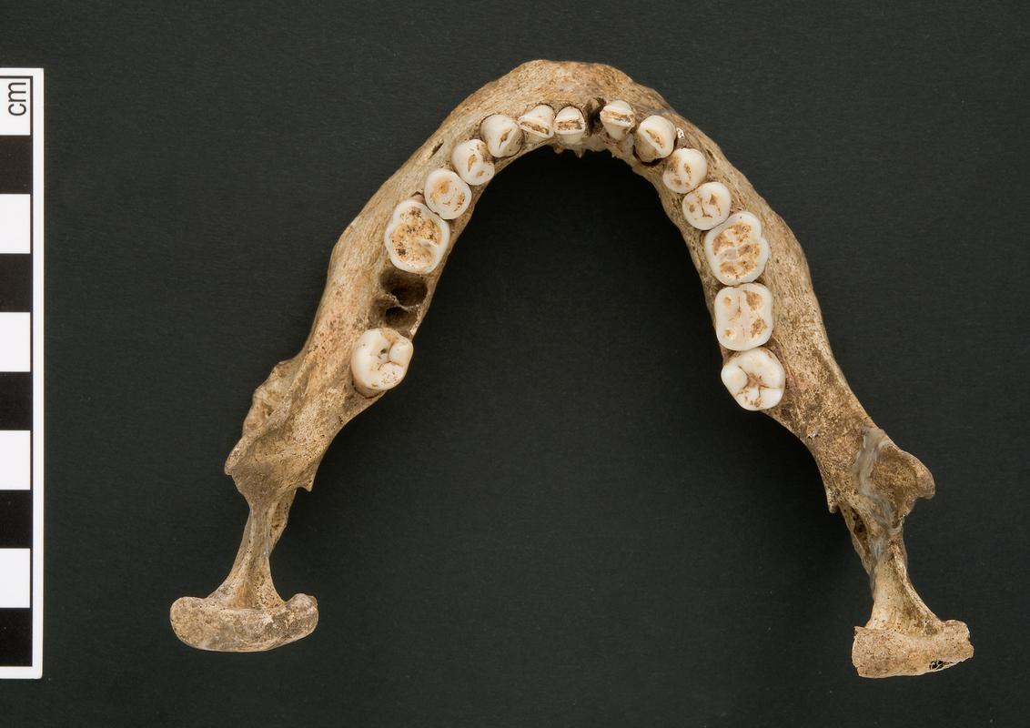 Early Medieval human remains